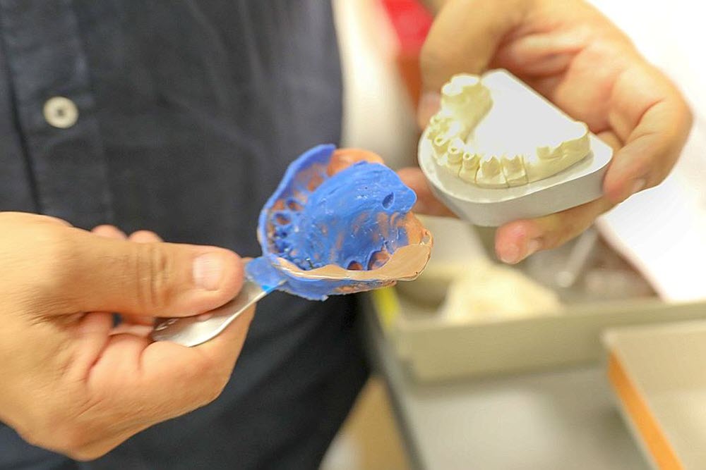 1-l-empreinte-90-des-empreintes-dentaires-qui-arrivent-au-laboratoire-(une-centaine-par-jour)-sont-encore-realisees-par-moulage-au-silicone-seuls-3-des-dentistes-disposent-de-cameras-optiques-du-platre-est-ensui